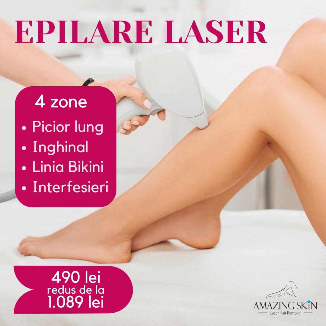 epilare laser 4 zone