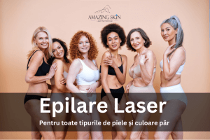 epilare laser pentru toate tipurile de piele